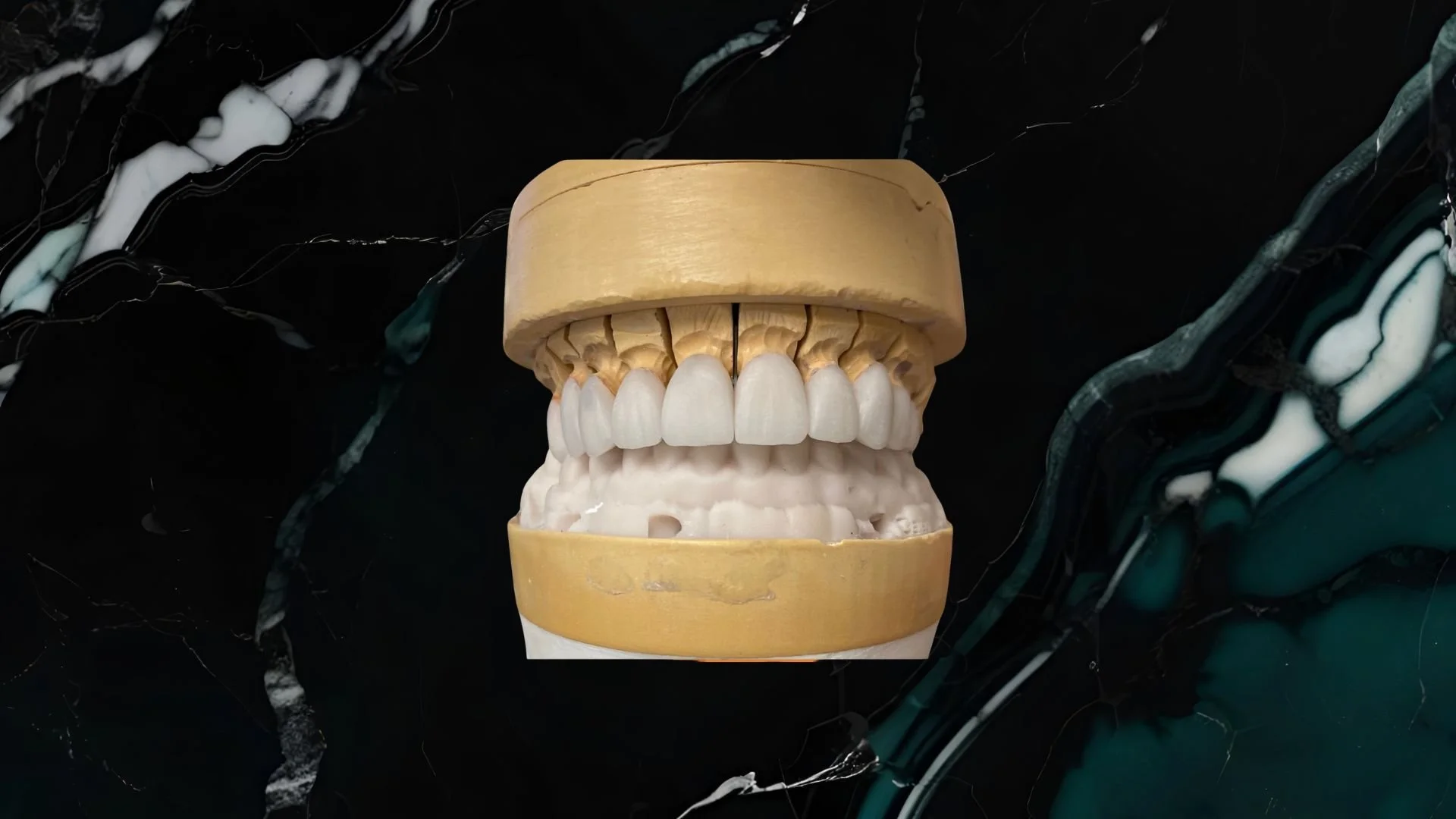 A model of human teeth with a wooden top, set against a dark marbled background.