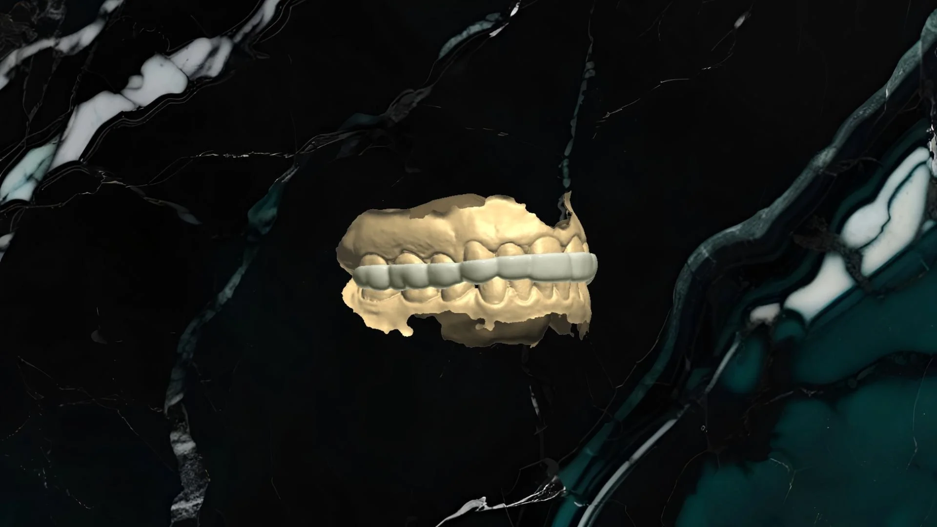 A digital art piece featuring a  Splint or Night Guard on a set of human teeth and jaw.