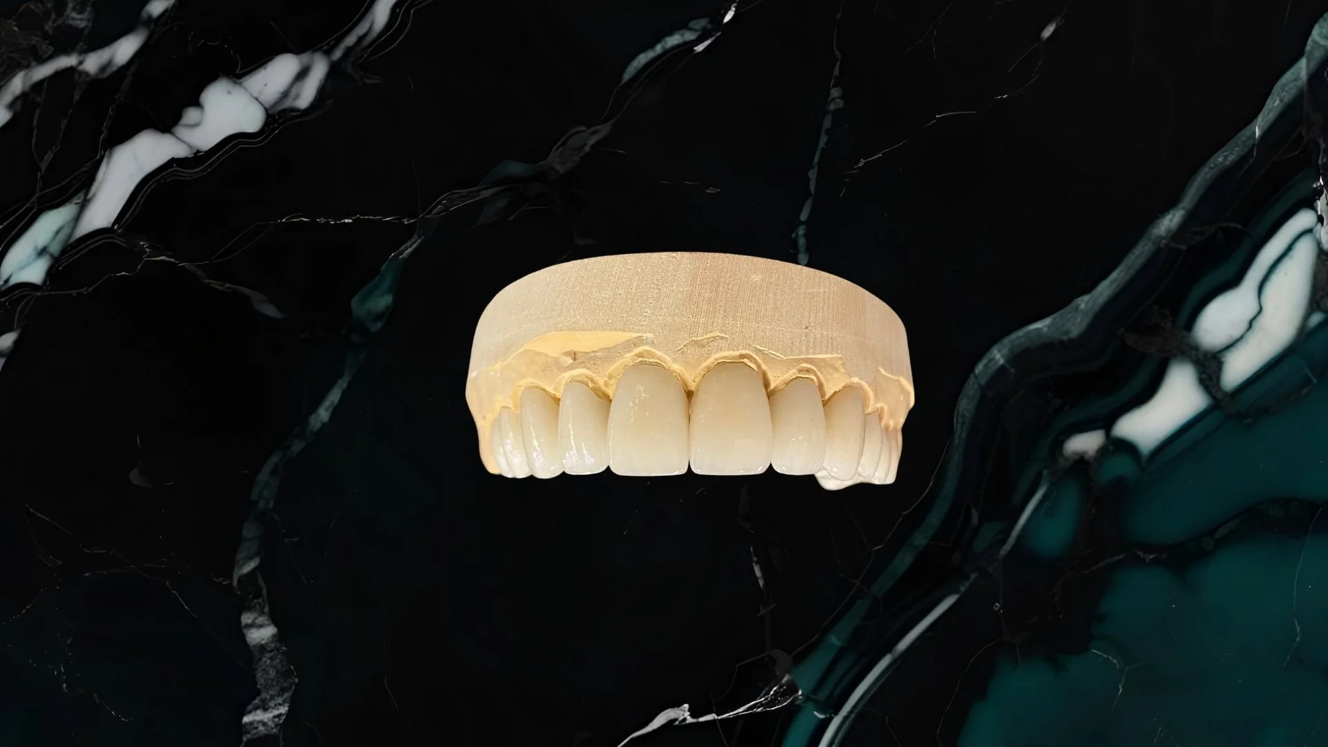 A set of upper veneers teeth with a plaster cast of the gum and jaw above them, placed on a dark, textured surface.