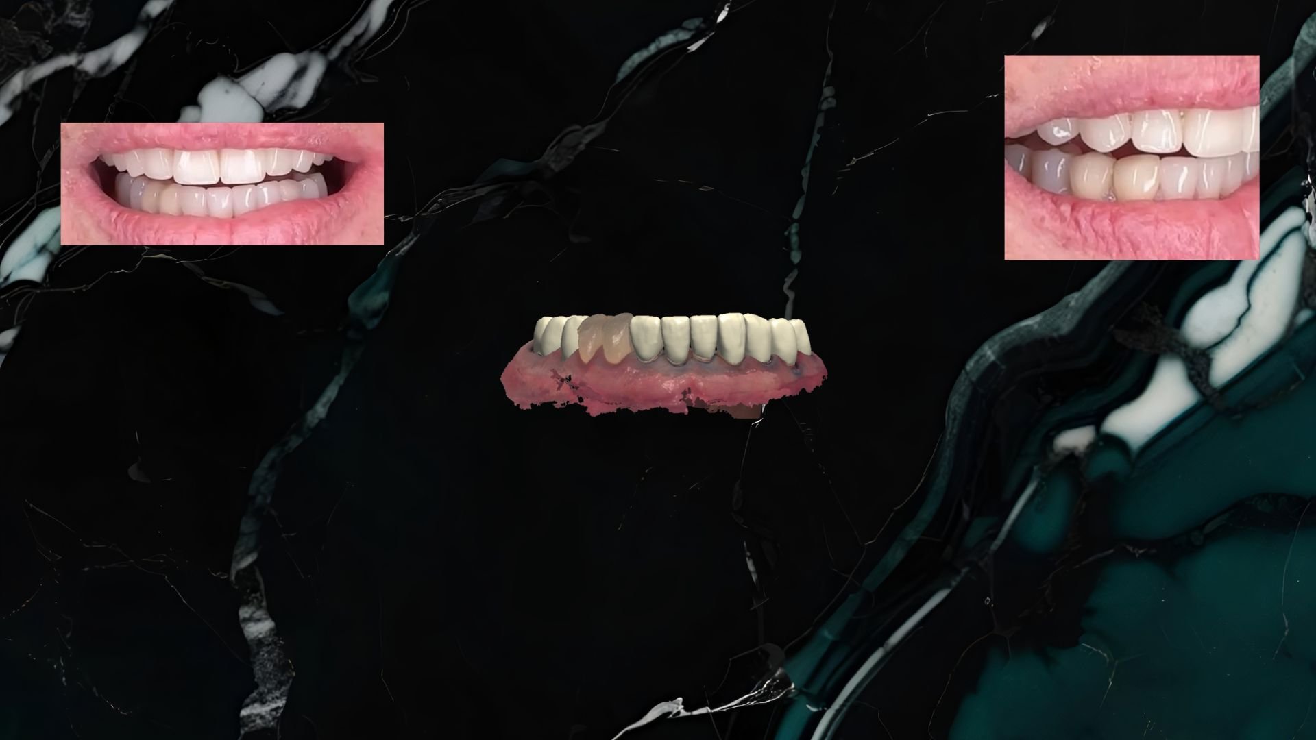 Digital collage featuring a teeth model, with close-up of upper and lower teeth, and a pair of lips in two separate frames.