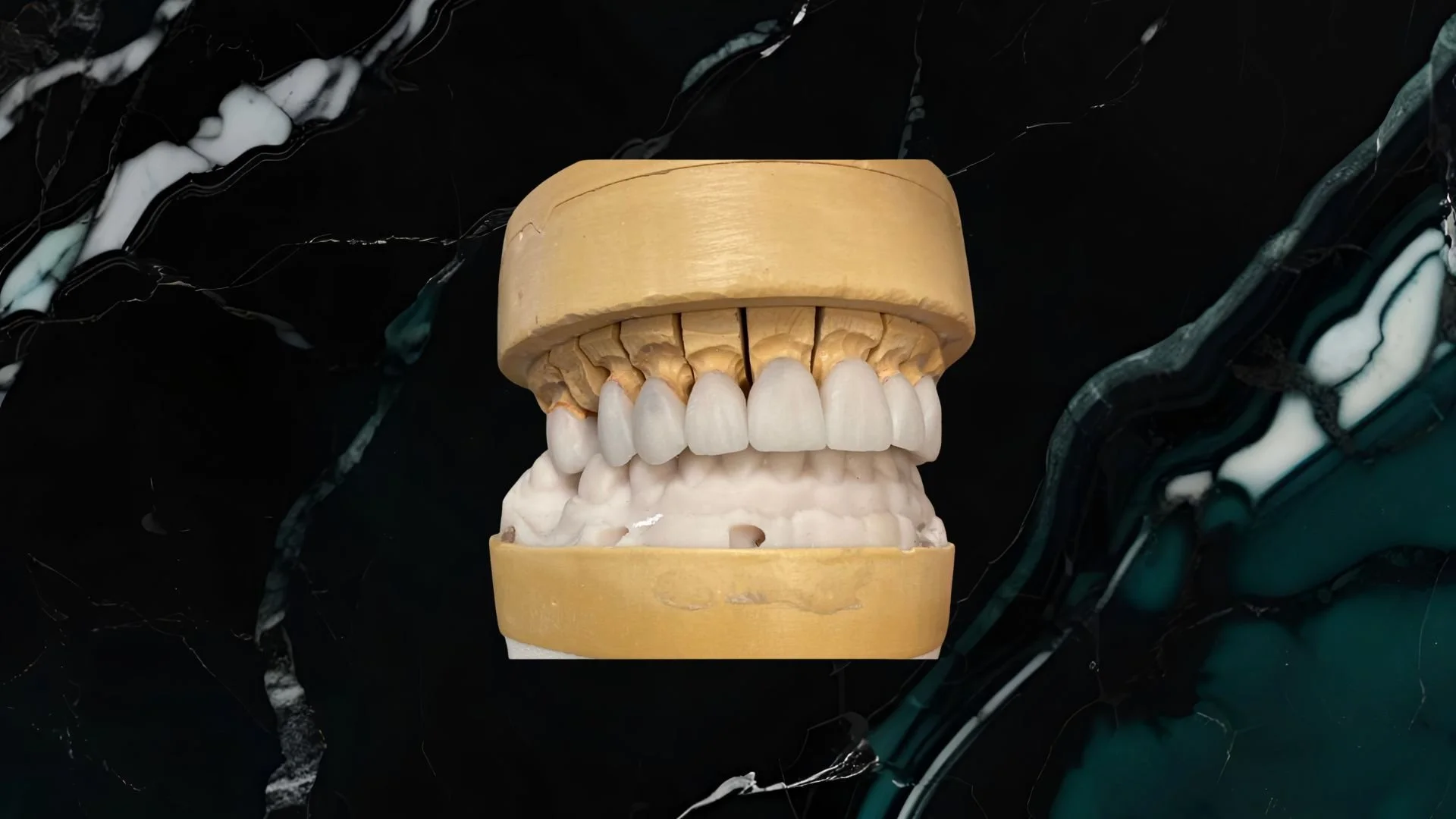 A dental model with teeth, set on a black and green marbled background.