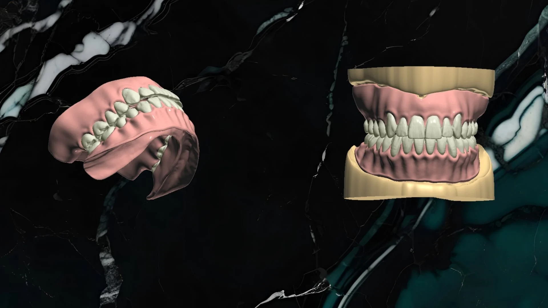 Digital rendering of a set of dentures on a black marble background, showing upper and lower teeth.