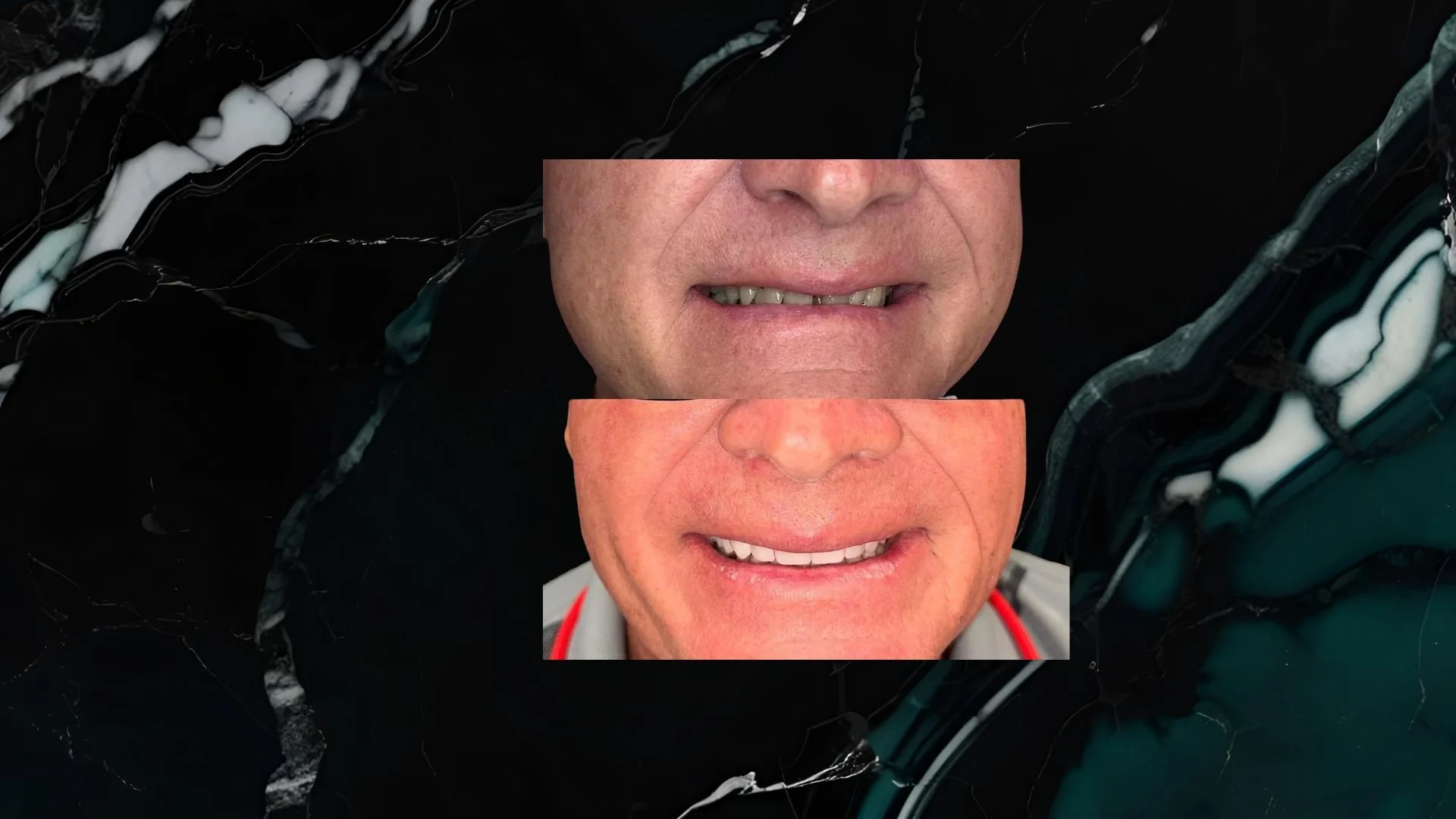Close-up of a man's face showing the lower half, with two smaller images of his upper face and mouth layered over it, set against a dark, marbled background.