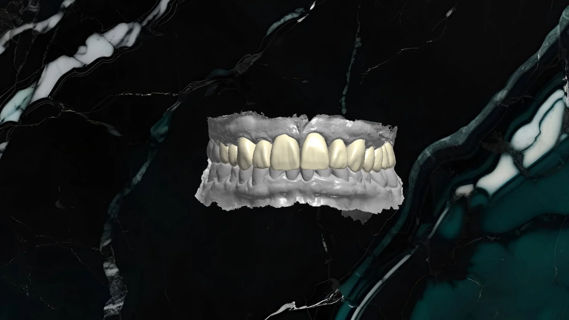 A digital image of a 3D model of a set of human teeth and gums, displayed against a black and marble-textured background.