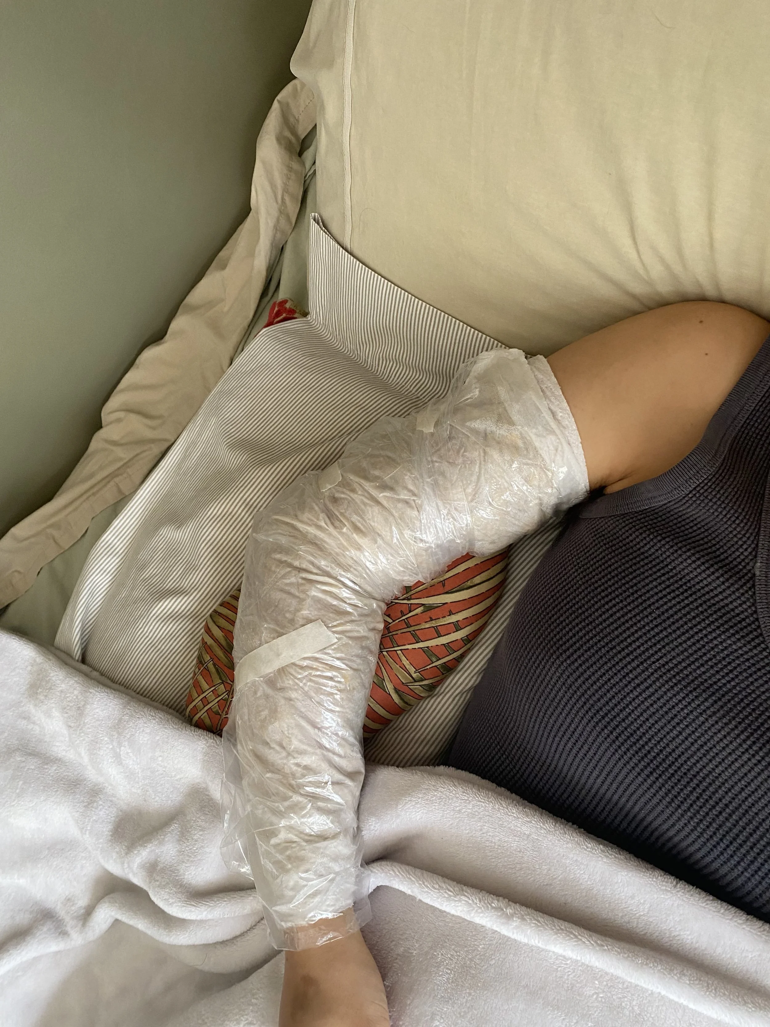 poultice-wrapped arm, supported by pillows
