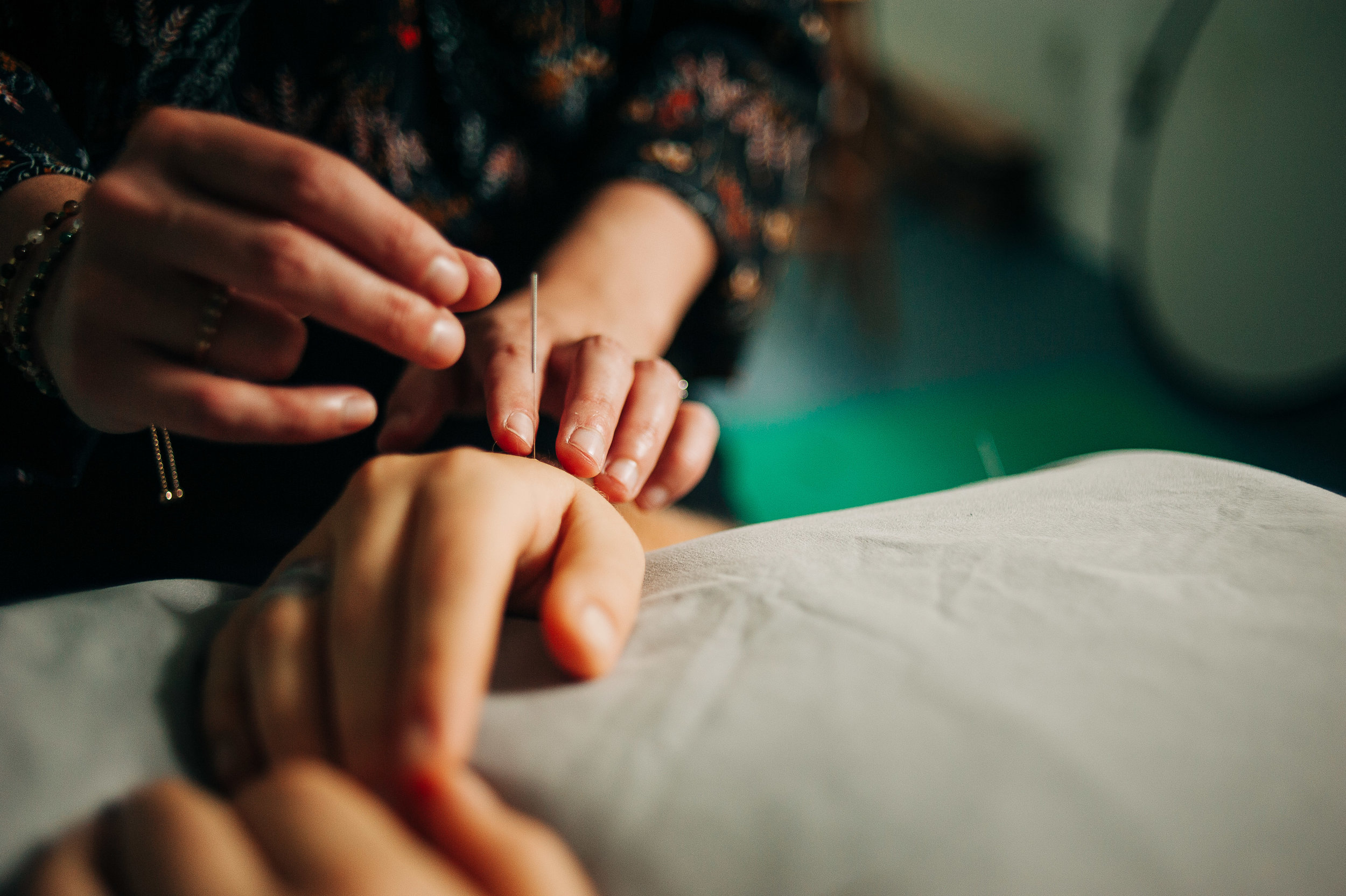 Your First Acupuncture Treatment