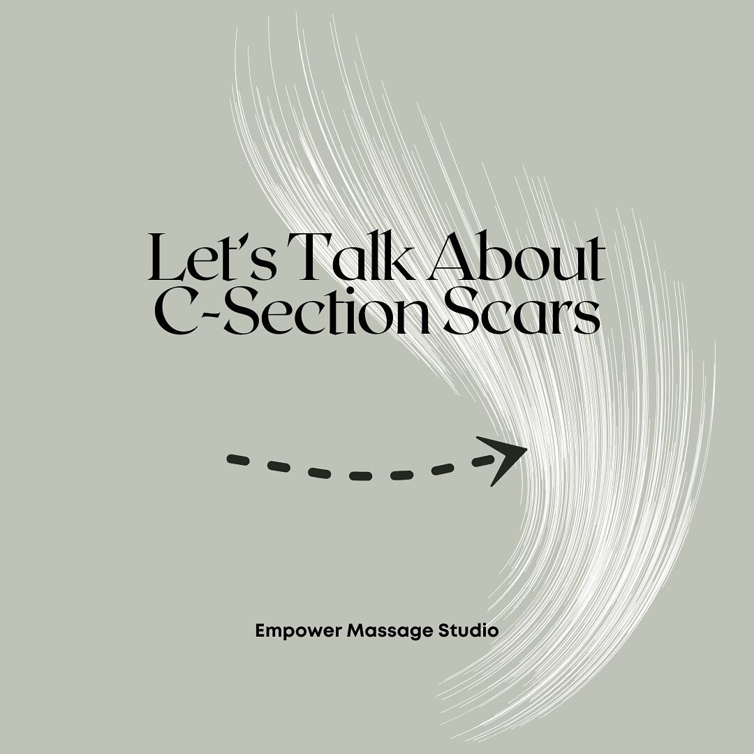 Chronic pain can often be followed back to previous surgery and early therapy can improve how your scar heals and the surrounding tissue functions. But remember, it&rsquo;s never too late to work on your scar and the impact it&rsquo;s had on surround