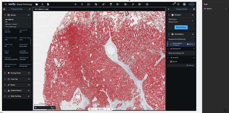 Modular Figma frame in action — toggling variants to produce new screen configurations