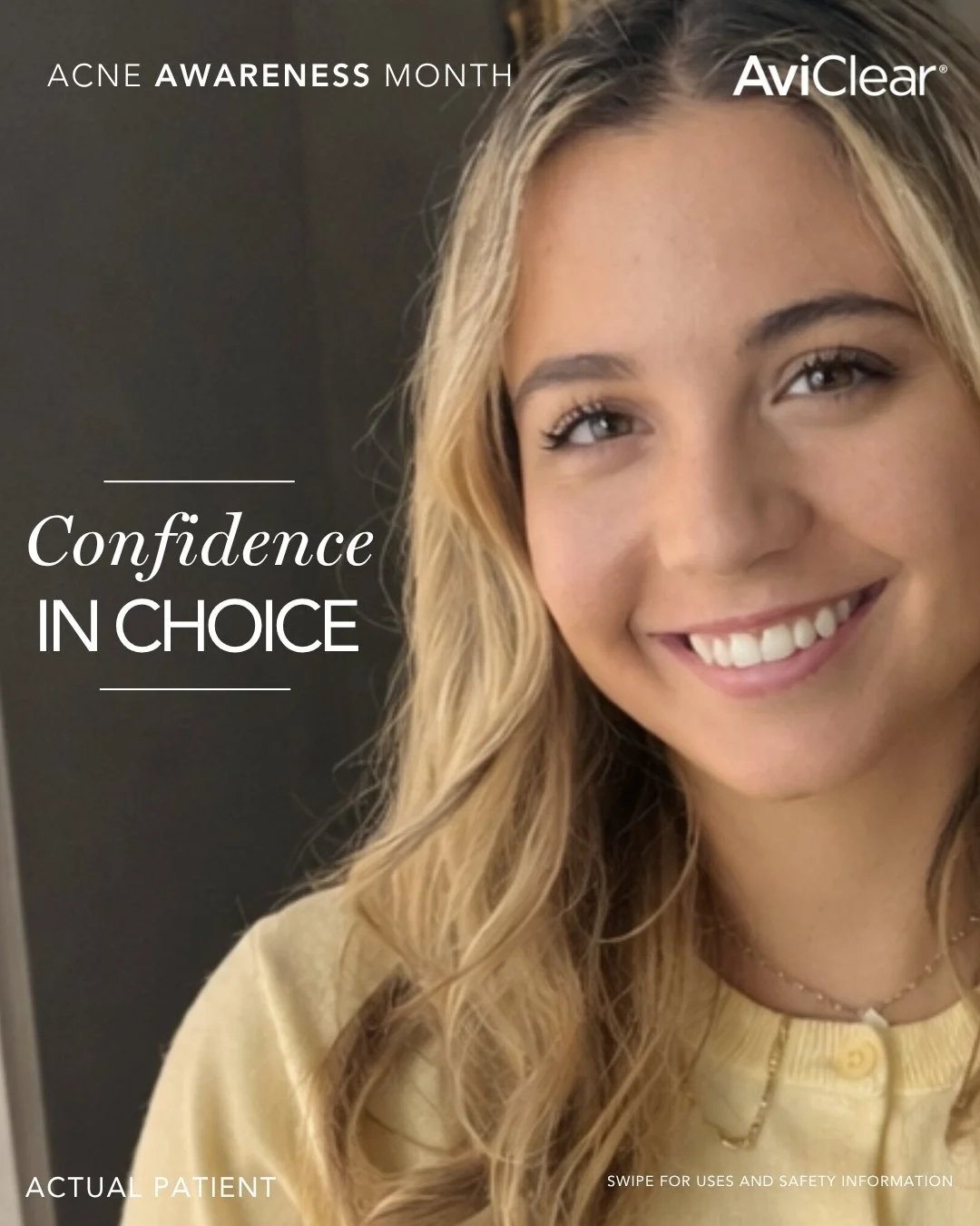&ldquo;I started getting really bad breakouts when I got off birth control&hellip; I chose AviClear because it&rsquo;s just a few laser sessions and targets the oil glands specifically. I saw results within the first three months and I&rsquo;m still 