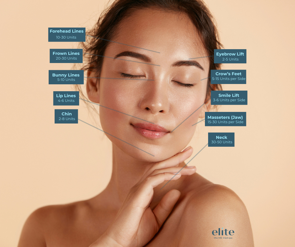 Botox Units Graphic 55 units.png