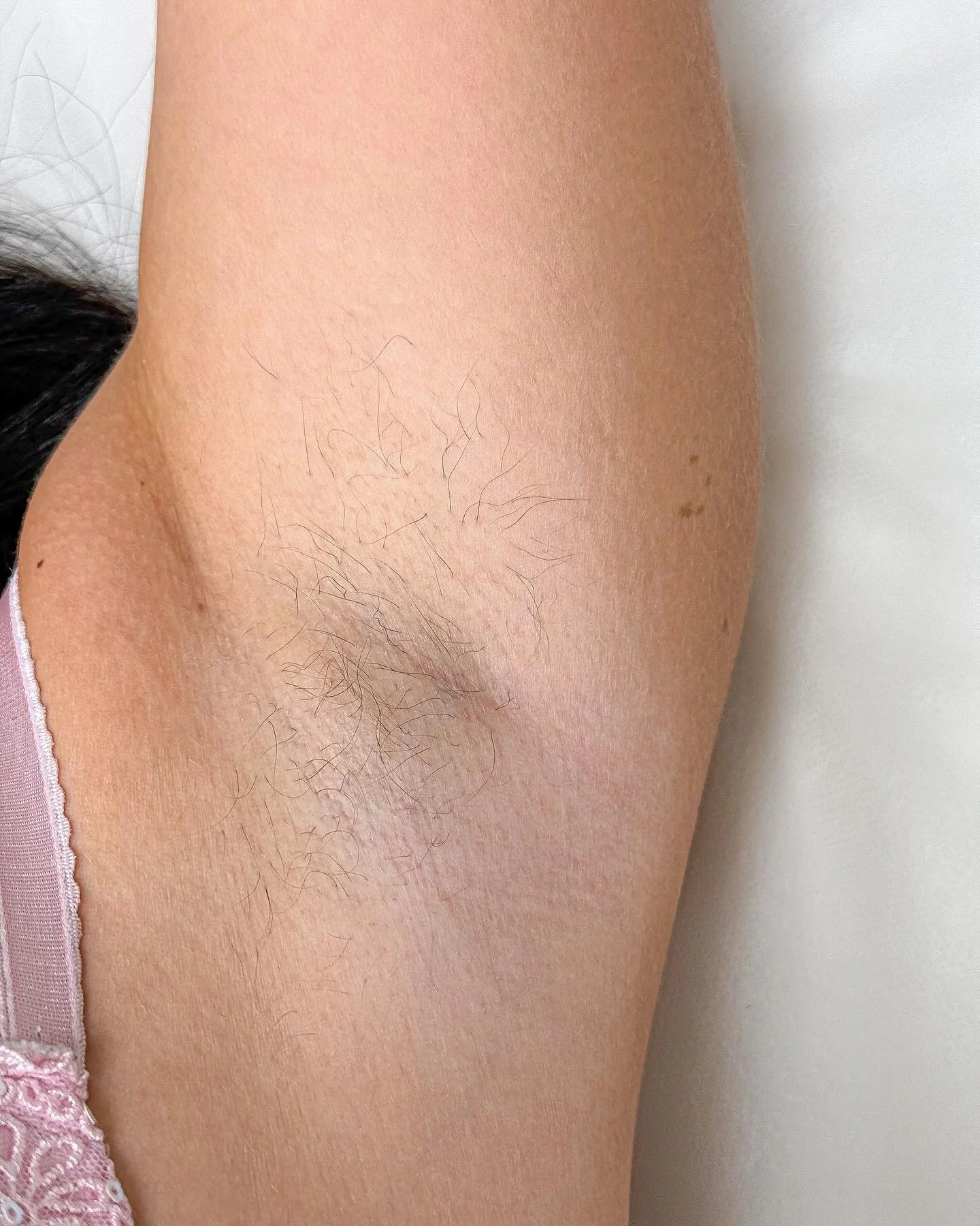 Bli h&aring;r fri p&aring; armh&aring;lorna! Boka nu f&ouml;r endast 400 kr ordinarie pris 800kr🤍

‼️50% P&Aring; F&Ouml;RSTA BES&Ouml;KET G&Aring;R BRA ATT V&Auml;LJA FLERA OMR&Aring;DEN‼️ 

✔ FRI KONSULATION 
✔ PERSONAL MED H&Ouml;G KOMPETENS OCH 