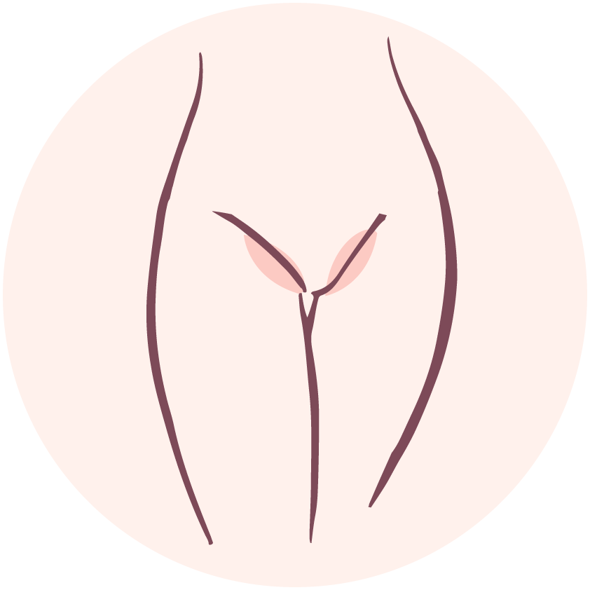 Bikini line比堅尼線HKD$ 3300原價HKD$6600