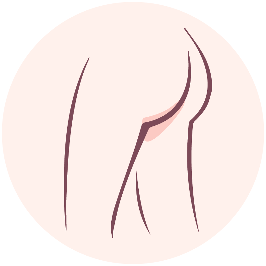 Anus肛門 HKD$ 3950原價HKD$7900