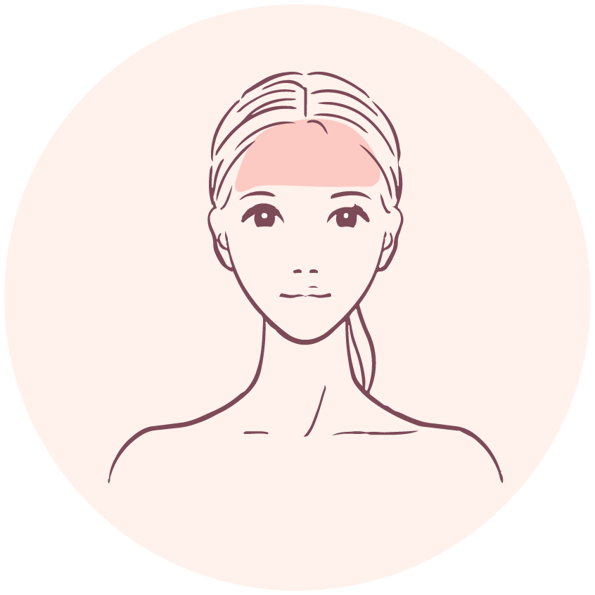 Forehead &amp; hair line前額和髮際線HKD$ 4950原價HKD$9900