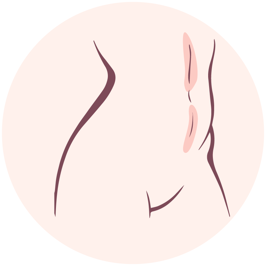 Belly Line肚線HKD$ 1900原價HKD$3800