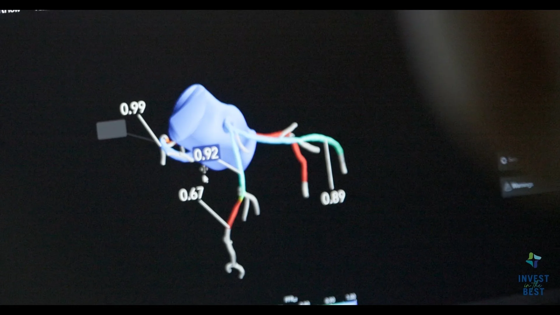 CHI Memorial Hospital - Invest in the Best Campaign - Cardiac Care