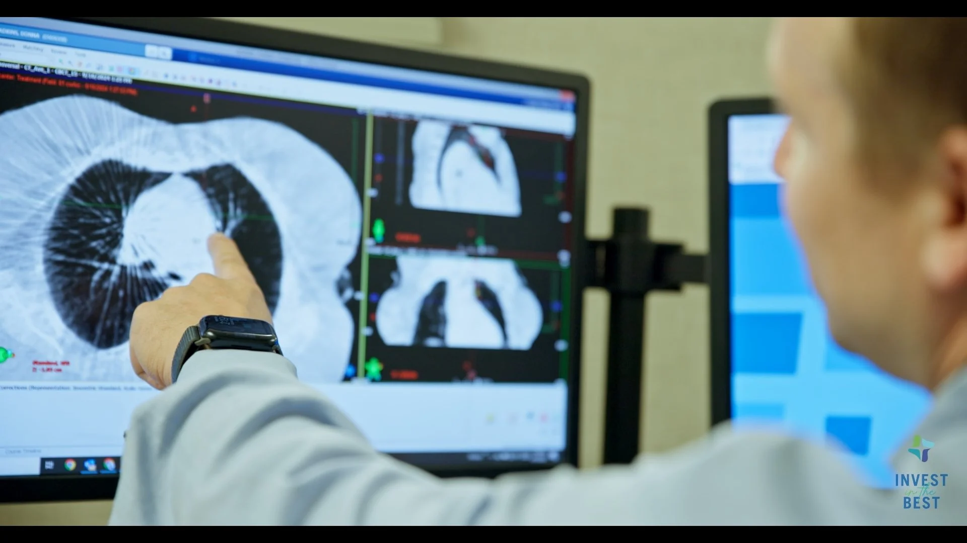 CHI Memorial Hospital - Invest in the Best Campaign - Oncology