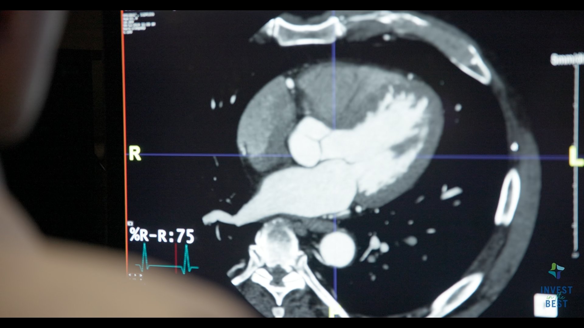 CHI Memorial Hospital - Invest in the Best Campaign - Cardiac Care