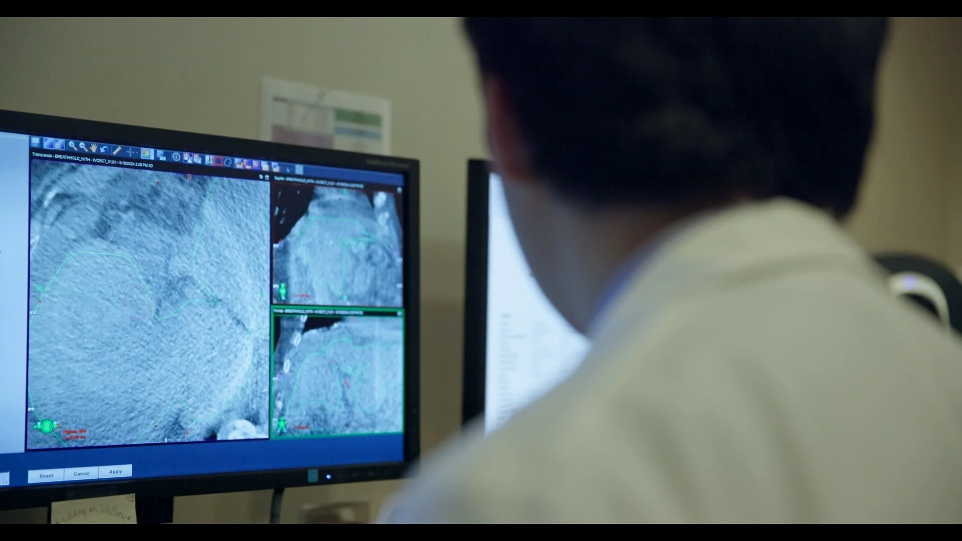 CHI Memorial Hospital - Invest in the Best Campaign - Oncology