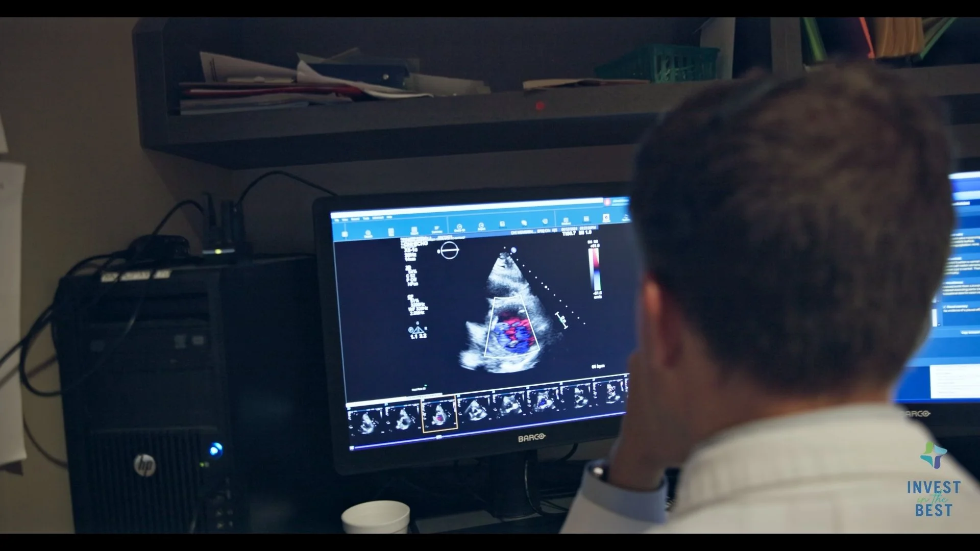 CHI Memorial Hospital - Invest in the Best Campaign - Cardiac Care