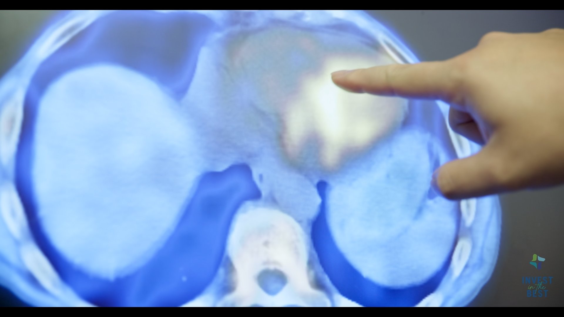 CHI Memorial Hospital - Invest in the Best Campaign - Cardiac Care