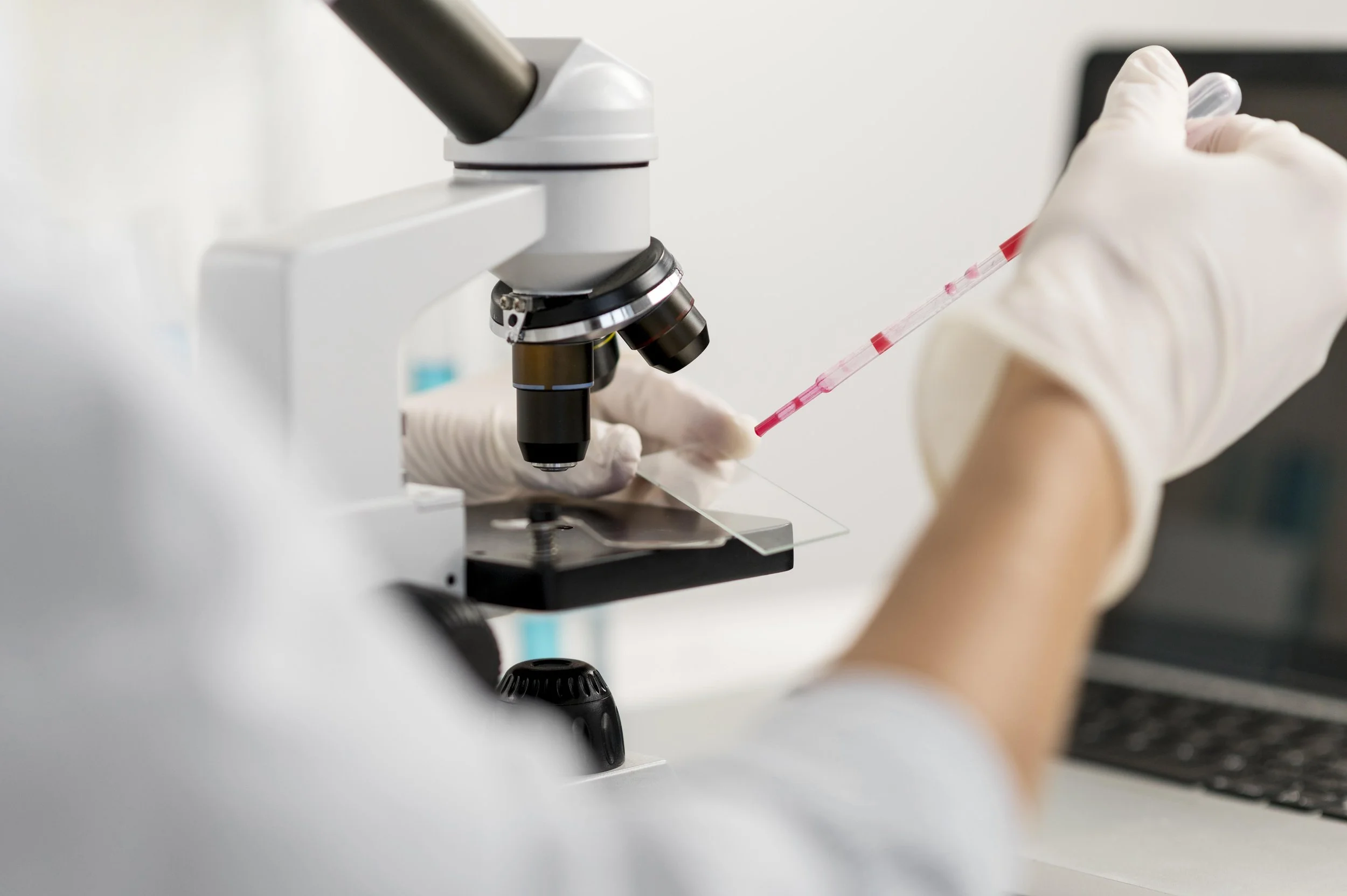Enrichment of Gut-Derived Metabolites in a Parkinson’s Disease Subtype with RBD