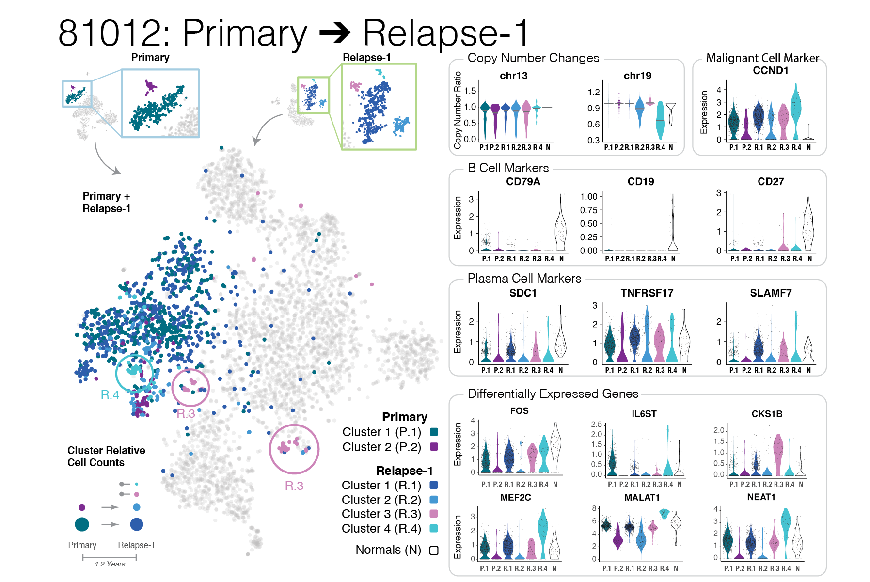 Patterns of plasma cell subpopulation shift from Primary to Relapse (Nature Communications, 2021): A complex multi-panel data figure illustrating the changes in plasma cell populations in multiple myeloma relapse.  Click image for details
