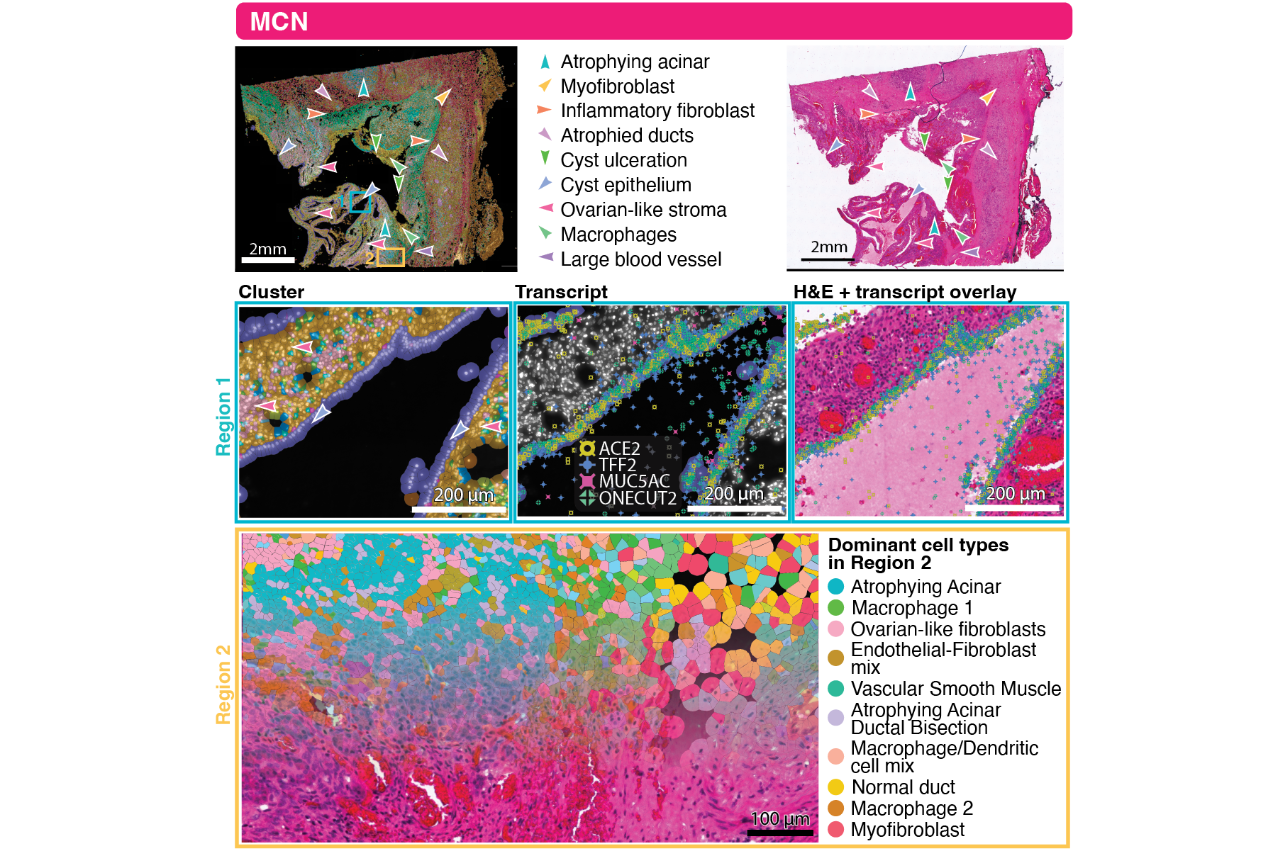 This figure was part of a successful grant application to HTAN2