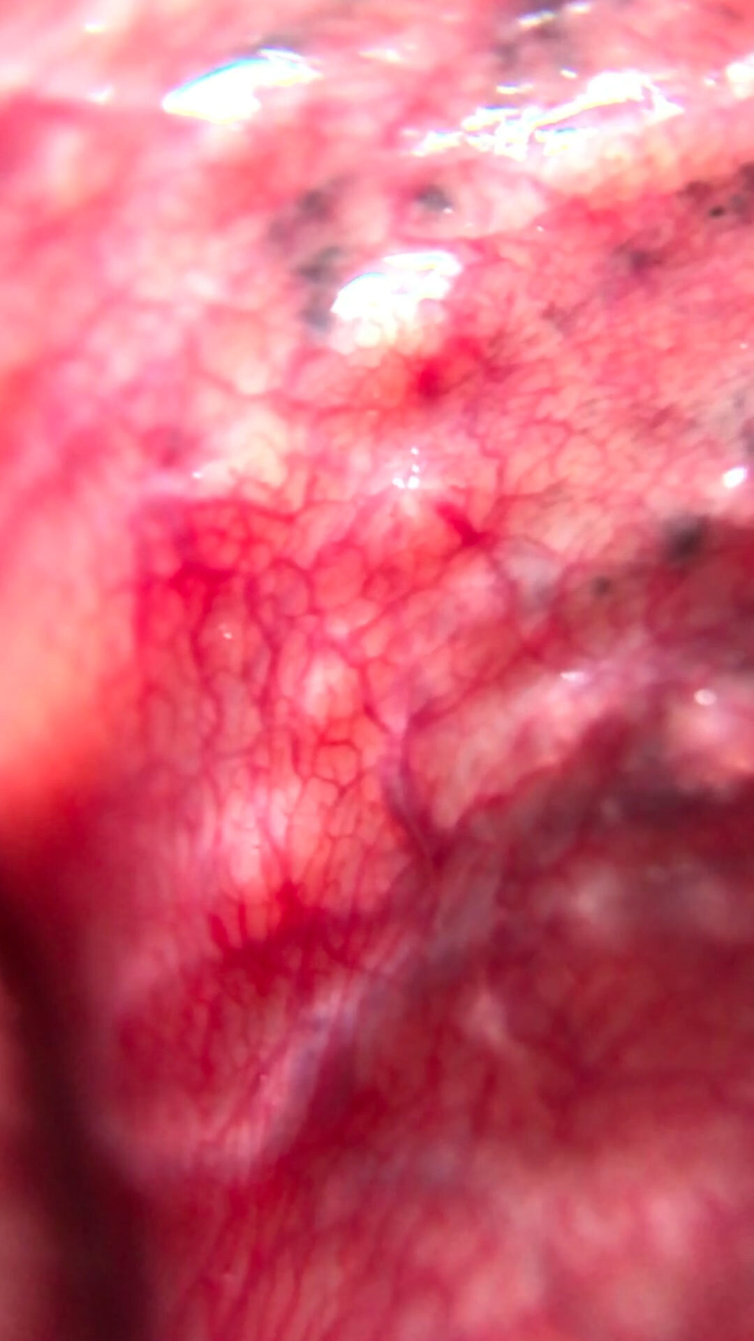 video stills