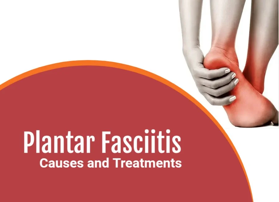 Plantar Fasciitis