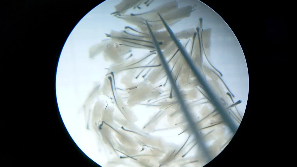 Factors Affecting the Growth and Survival of Follicular Grafts