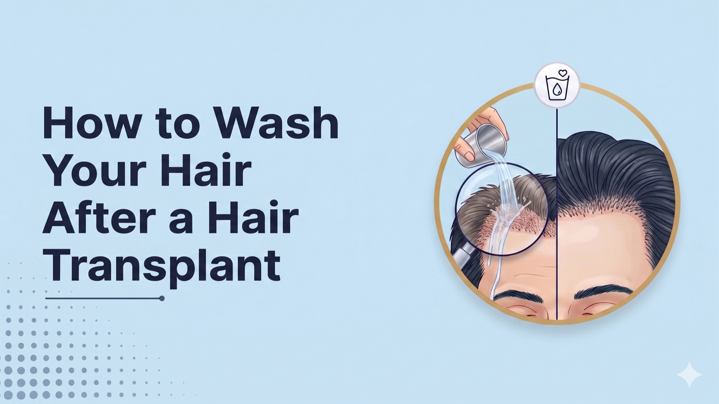 How to Wash Your Hair After a Hair Transplant