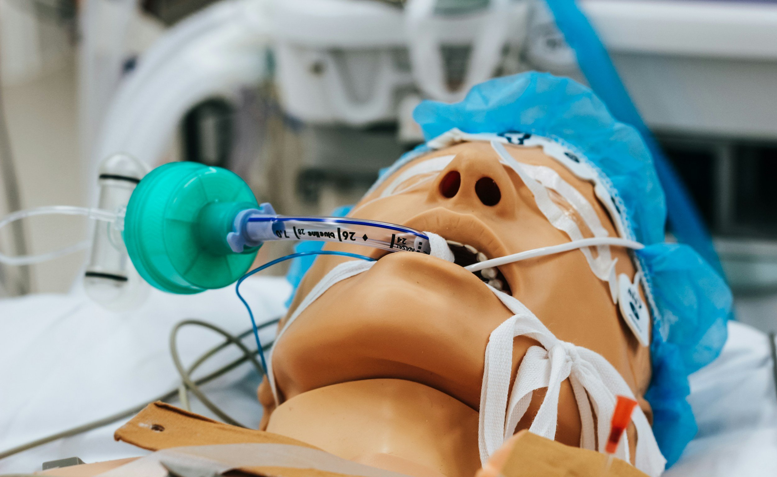 Hoarseness After Intubation: Vocal Risks from Surgery