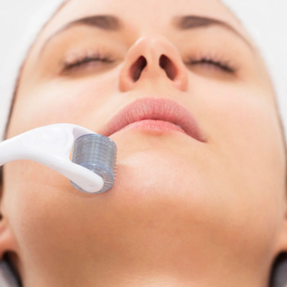 Microneedling by Roller.jpg