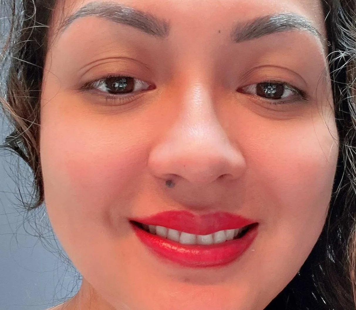 Lip Tattoo- Day after procedure