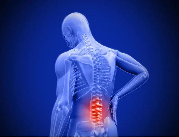 ❓Which medicines are best for treatment of lower back pain in adults? 

This Cochrane overview summarises evidence from seven reviews that included 103 studies. 

https://doi.org/10.1002/14651858.CD013815.pub2
#BackPain