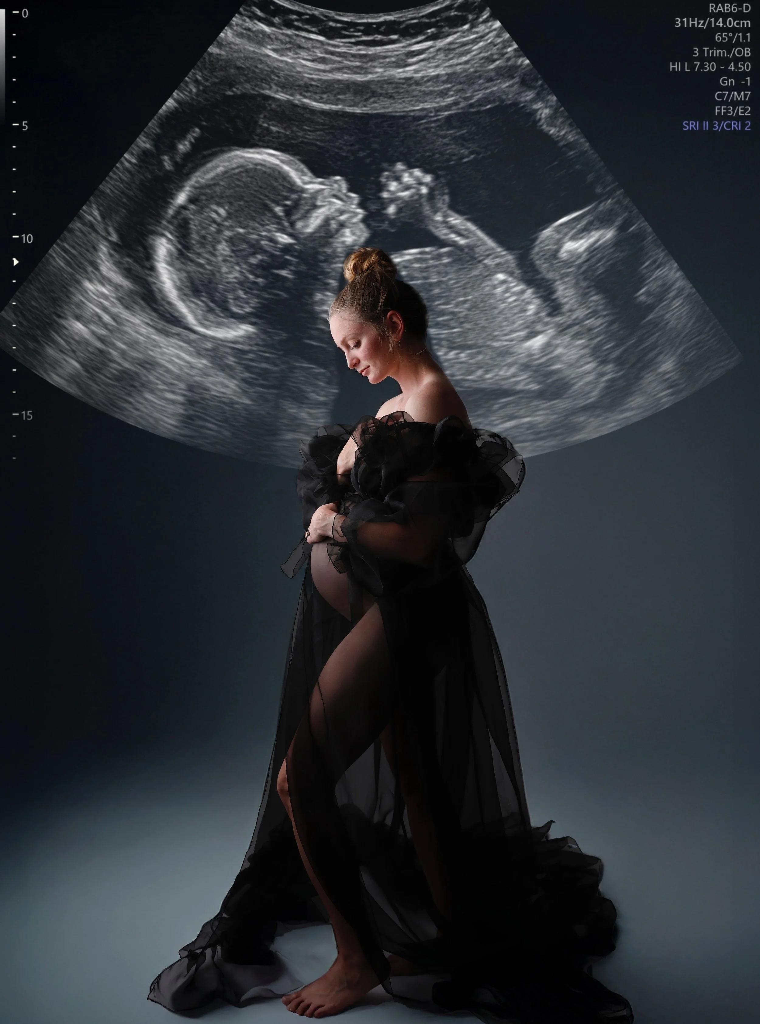 I love this so much I want to go grab my pregnancy photos and scans..such a great memory.