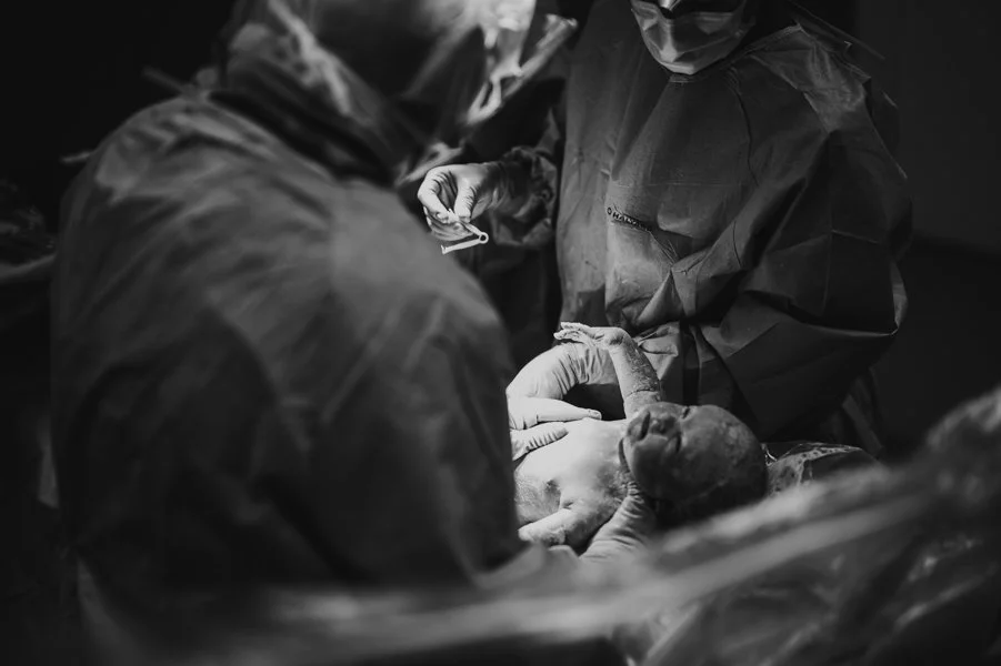 c section birth photography Elizabeth Anderson photography