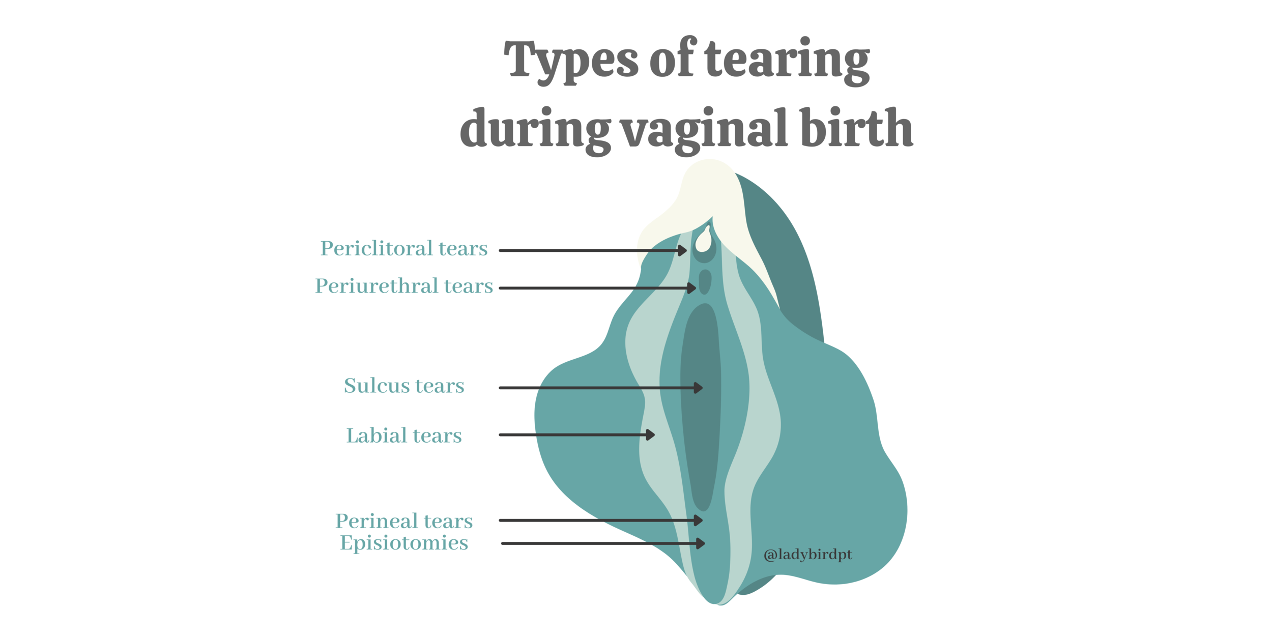 Vagina After Birth: 10 Ways to Soothe the Pain