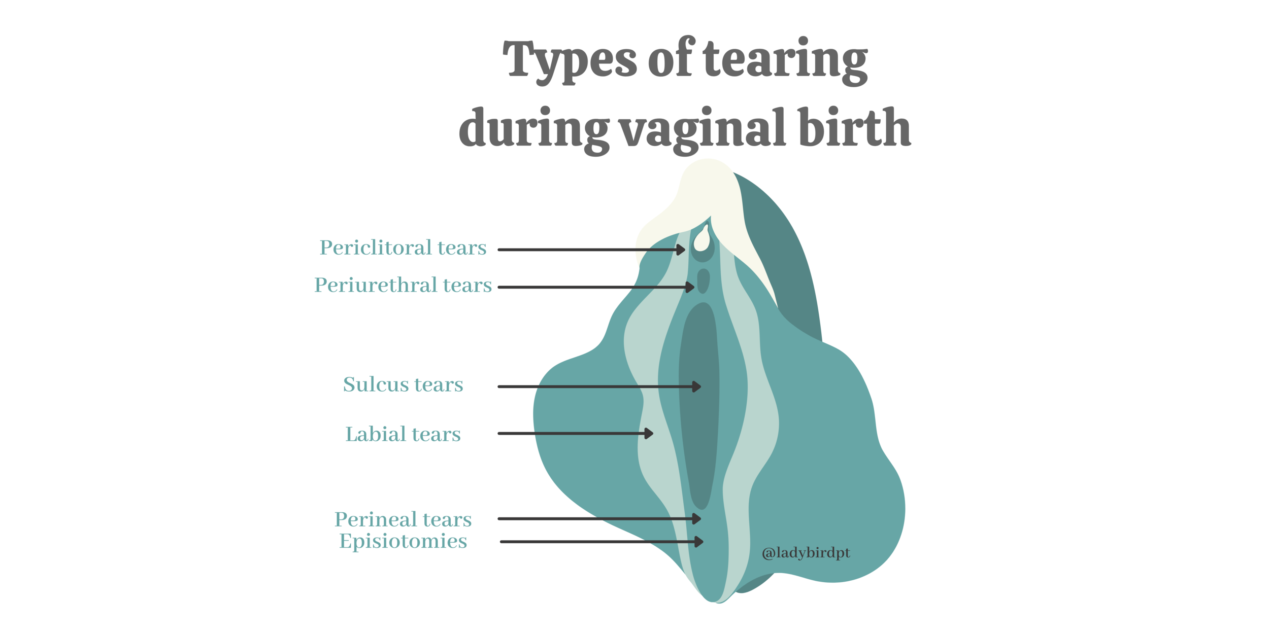 Definition & Meaning of Tear