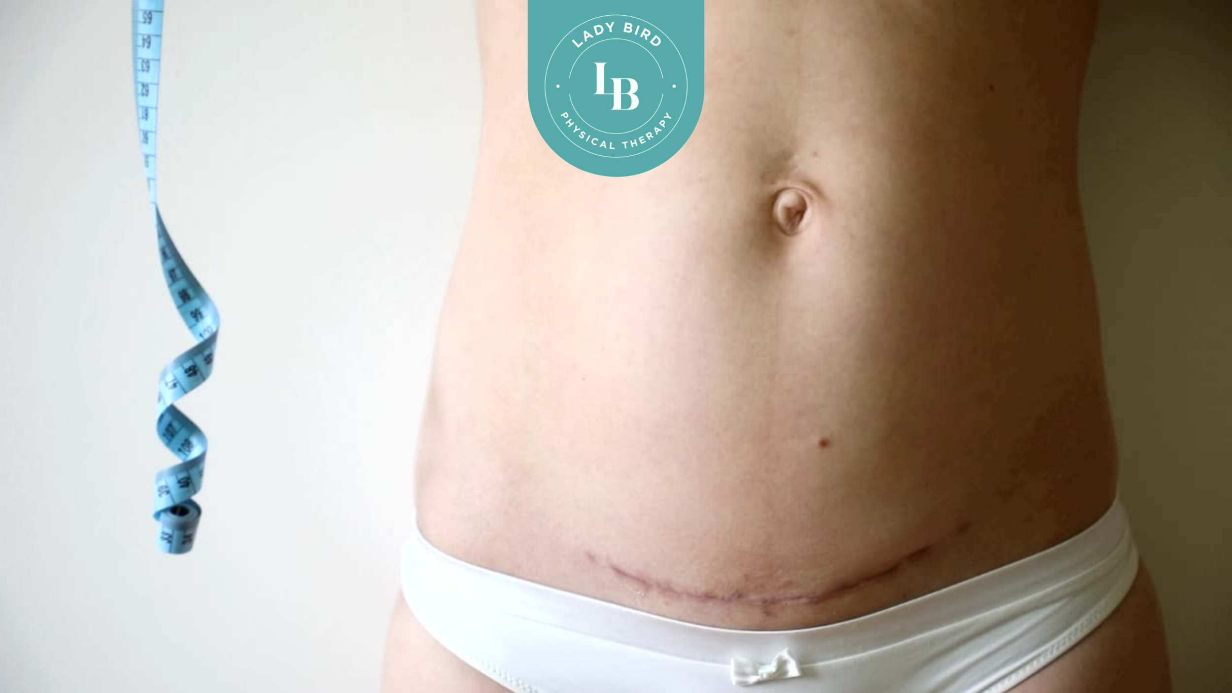 How Do I Take Care of a C-Section Scar?