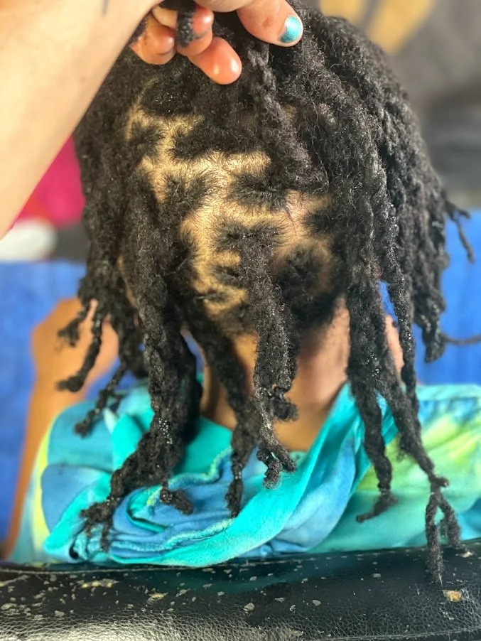 After kid loc retwist/1