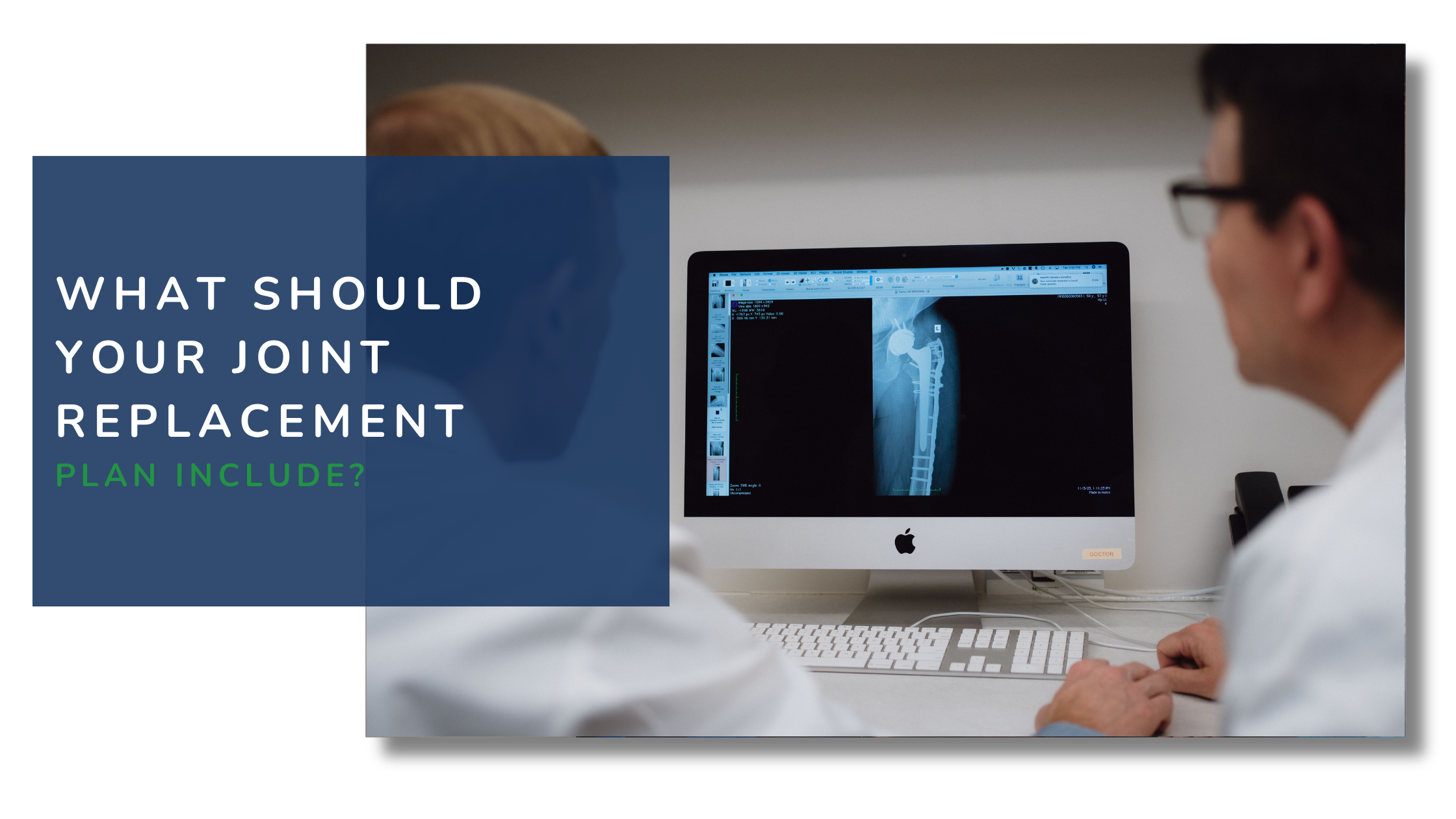 What Should Be Included in Your Joint Replacement Surgery and Recovery Plan?