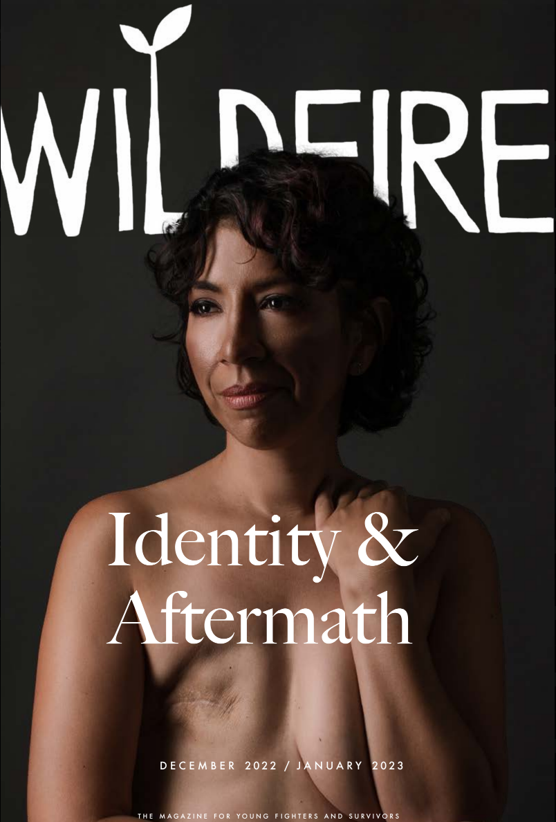 A woman post unilateral mastectomy.