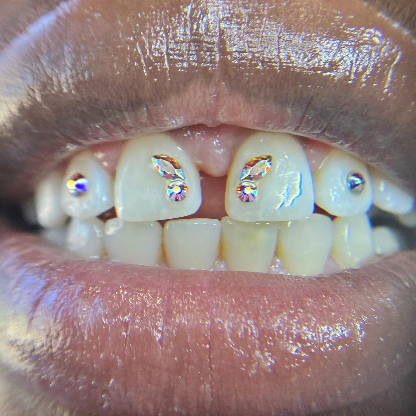 Crystal Butterfly Tooth Gem - SmileGems