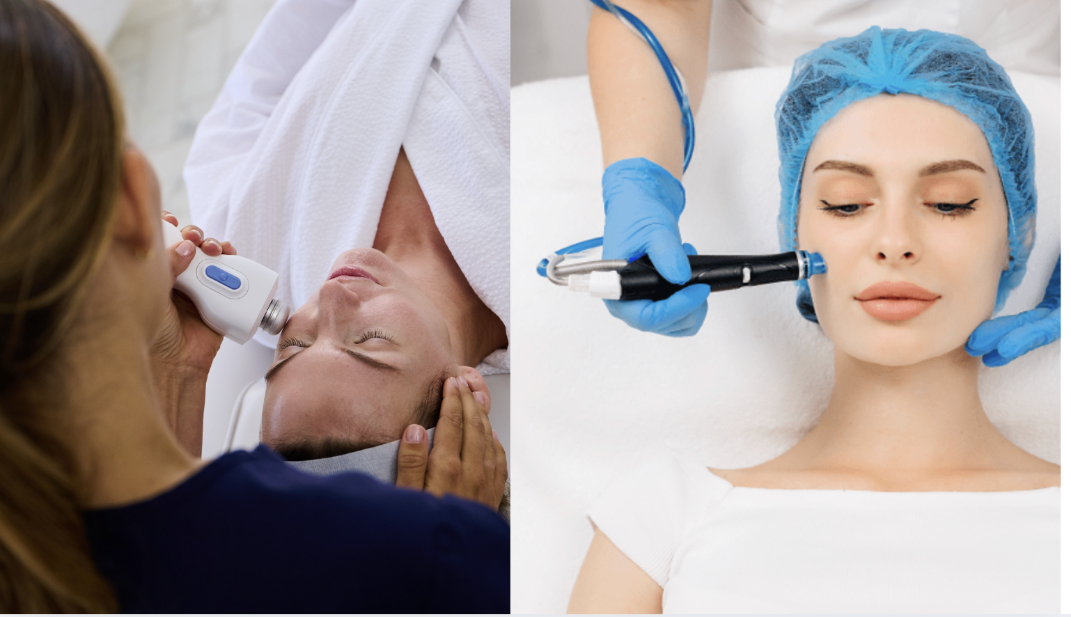 Glacial vs HydraFacial: Which Facial Is Right for You?