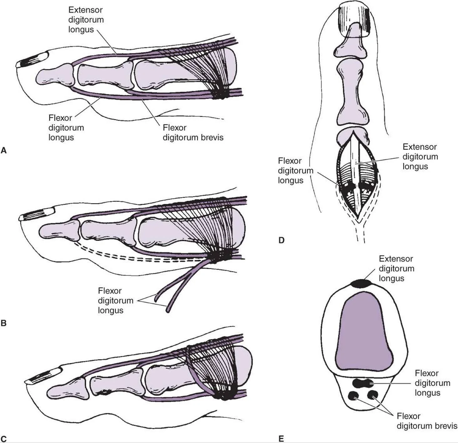 Plantar Plate Review of newest evidence. — Doctor Andrés León