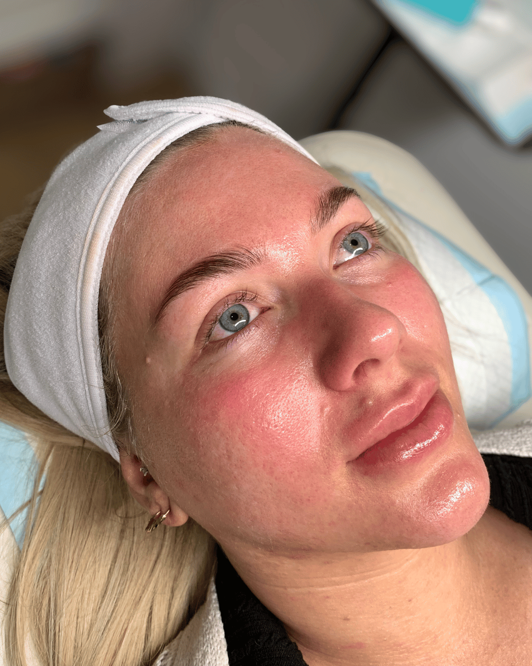When Does Collagen Start Declining? The Science Behind Skin Ageing