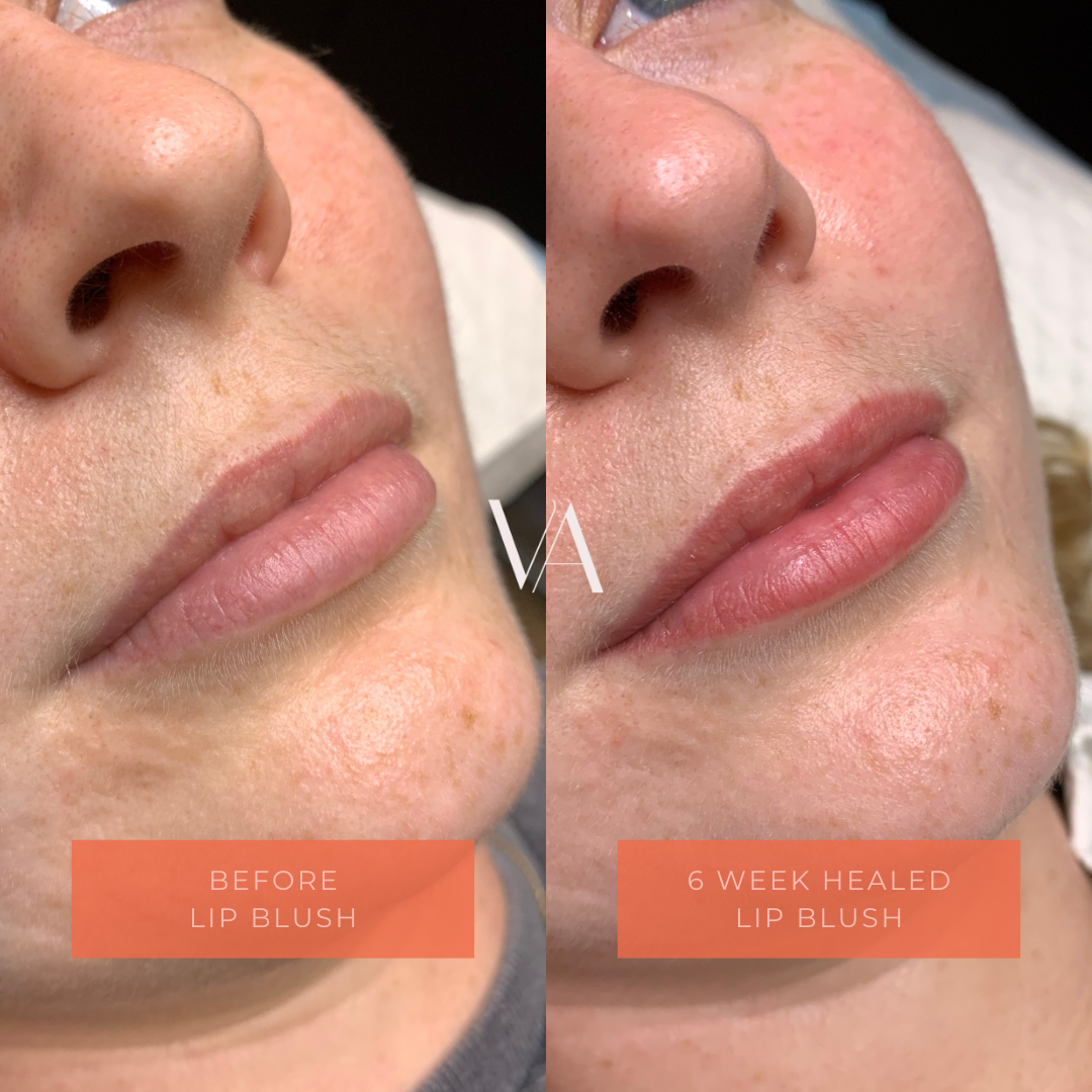 Before and After natural lip blush cosmetic tattoo 