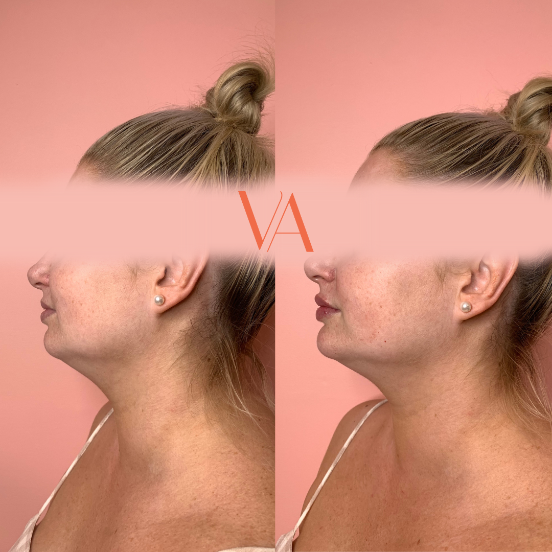 Untitled design-7 2.PNG